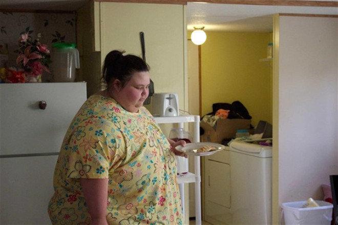 229 kiloqram arıqlayıb bu hala düşdü -  FOTOLAR